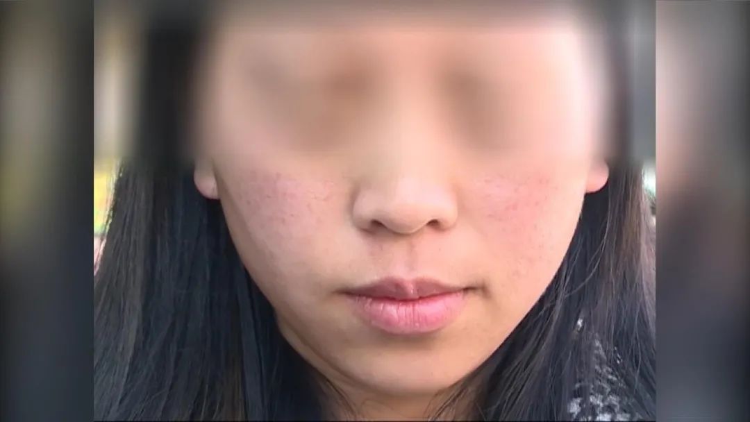 女子洗把脸花了8000多,女子洗把脸花了8000元