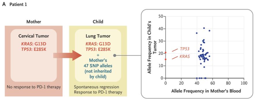 NEJM：宫颈癌细胞竟能经产道进入婴儿的肺！科学家首次发现宫颈癌母亲顺产导致儿子患肺癌的案例，母子肿瘤基因谱高度吻合丨临床大发现