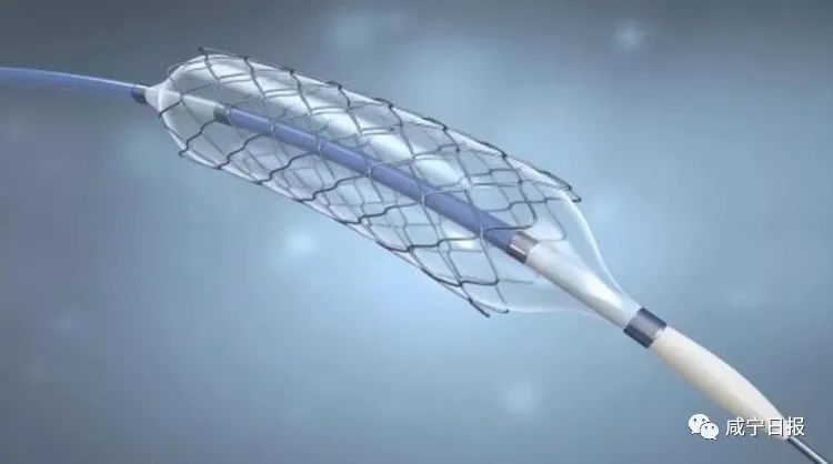 人均节省万余元！平价支架落地咸宁