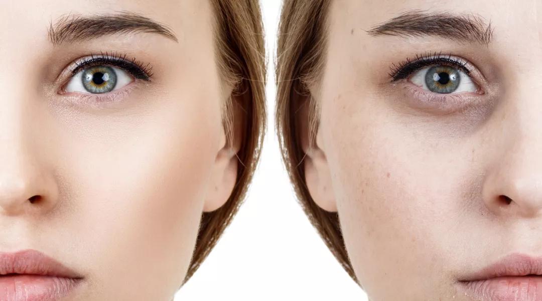 去黑眼圈公认最好用的10大眼霜,推荐几款黑眼圈有效的眼霜