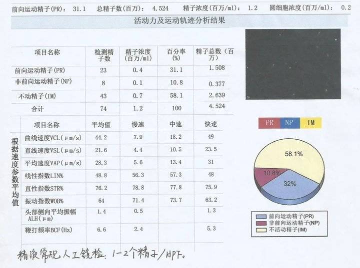 男子无精子用什么药,无精子症几个月后变有精子