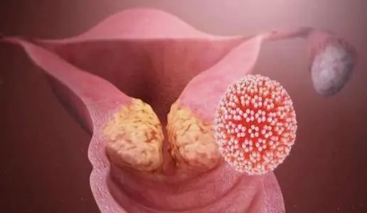 妇幼保健院卵巢肿瘤手术,九江市妇幼保健院肿瘤科