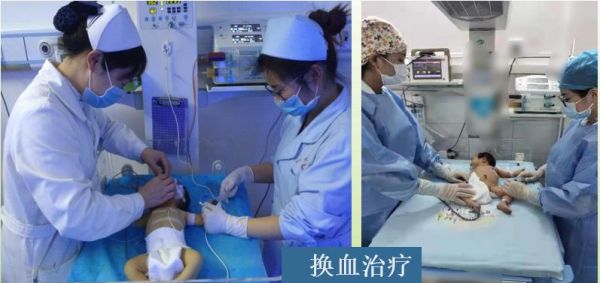 健康育儿早知道新生儿黄疸,新生宝宝病理性黄疸如何治疗