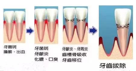 helen榻跨,Helen榻跨涓績