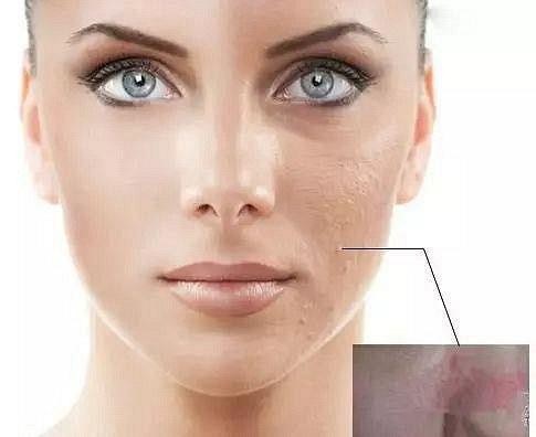 拒绝油腻！拿什么拯救你我的油性皮肤？