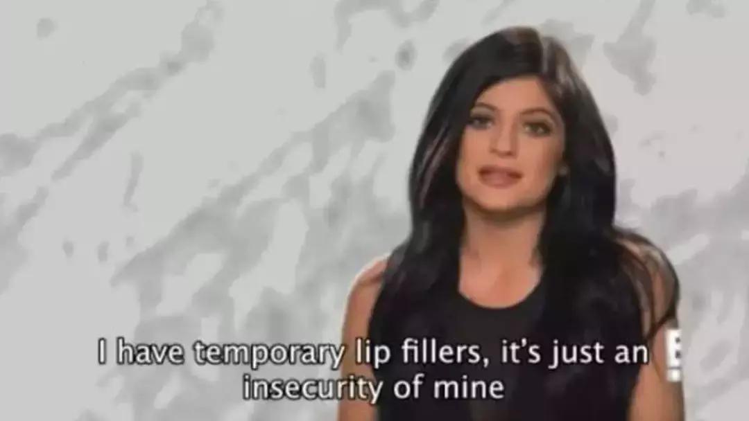 厚嘴唇有多美,厚嘴唇也很好看的女生