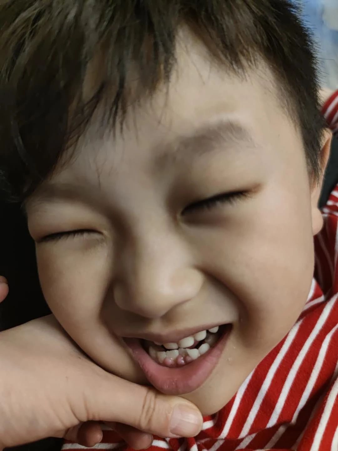 小孩口腔最里面有双排牙,孩子嘴里出了好多牙