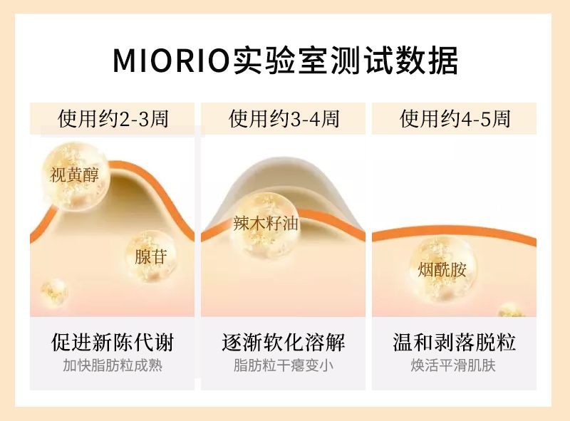 脂肪粒怎么用针挑出的,脂肪粒多久可以用针挑出来