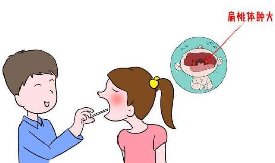 割掉扁桃体影响唱歌吗,割掉扁桃体会影响什么