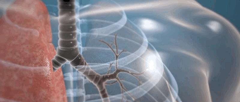 哮喘过敏症的症状,呼吸道过敏哮喘症状