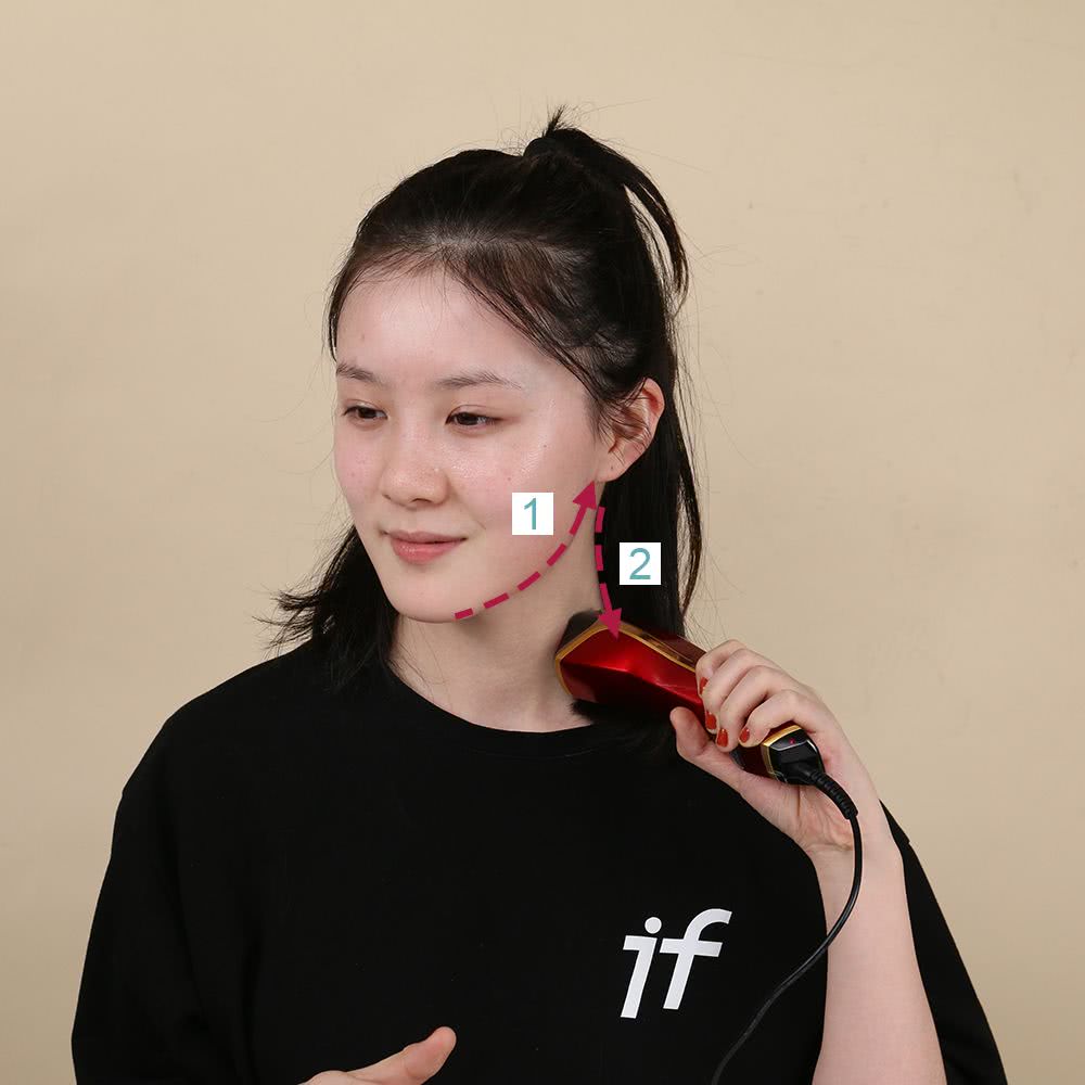 微整的真实效果,微整蜕变过程