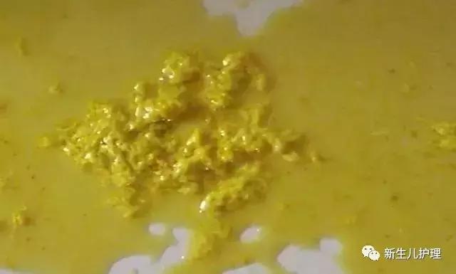 新手爸妈｜奶瓣、绿便、腹泻、便秘……宝宝各种便便真图全解必备