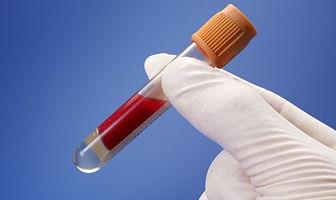 奶粉全脂牛奶和脱脂牛奶的区别,全脂奶粉跟脱脂牛奶区别