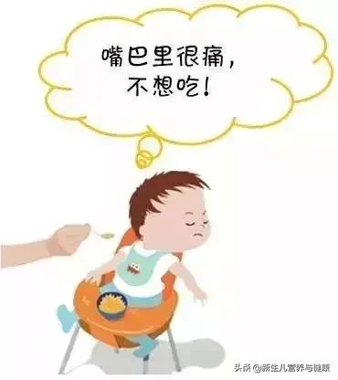 疱疹性咽峡炎可以不用吃药吗,疱疹性咽峡炎用什么药可以预防