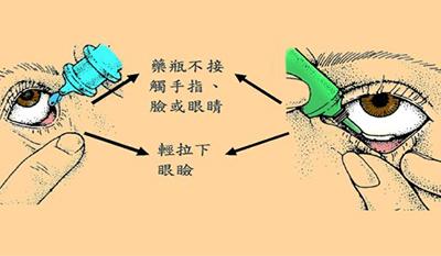 眼药水滴了近视会好吗,眼药水辟谣