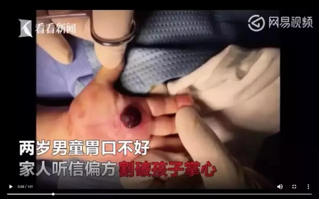 儿科偏方大全100个,民间偏方害惨小孩