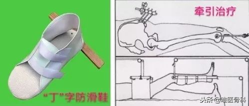 老年人的最后一次骨折,老年人请谨防人生最后一次骨折