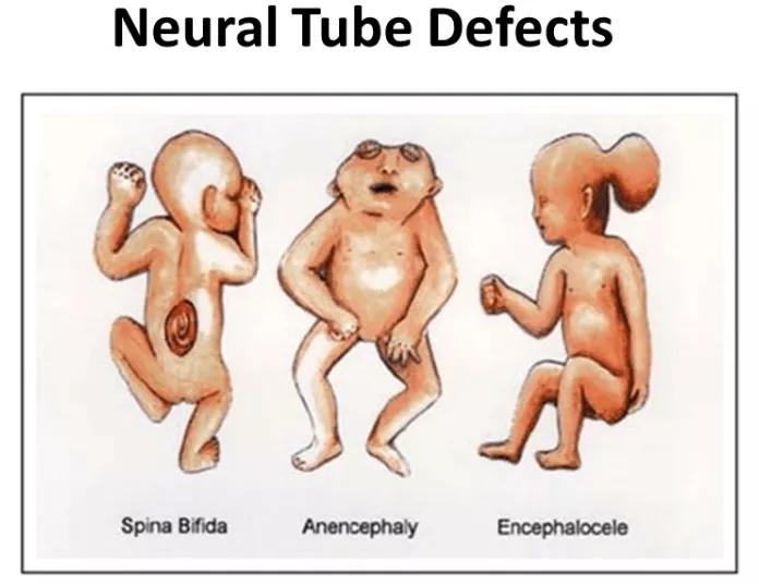 宝宝吃叶酸对身体有什么影响,多吃叶酸对宝宝有什么好处