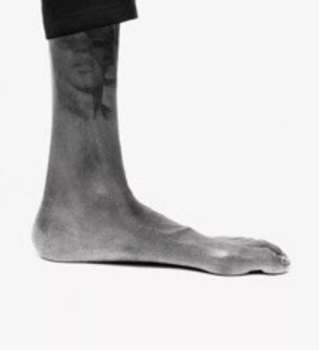 杜兰特受伤的脚为什么那么瘦,杜兰特的脚大了一些