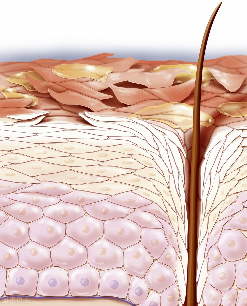 认识常见妇科肿瘤,外阴血管瘤成因