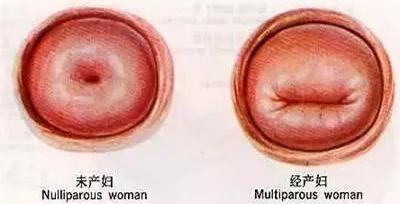 如何判断是否阴虚火旺,如何判断是否阴虱