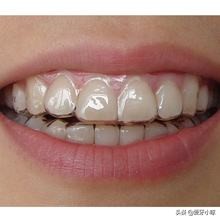 后摄像头拍照脸歪嘴歪怎么办,拍照脸歪嘴歪与现实一样吗