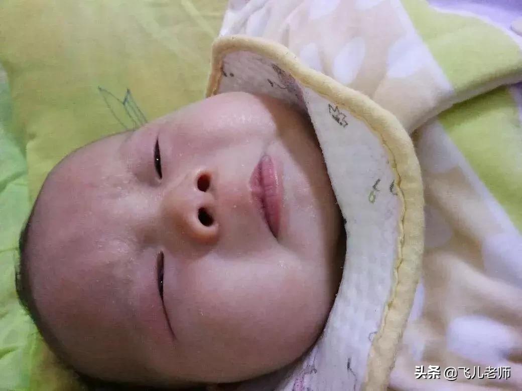 15个月的小宝宝突然哭得很凶,两月多的宝宝为什么老哭