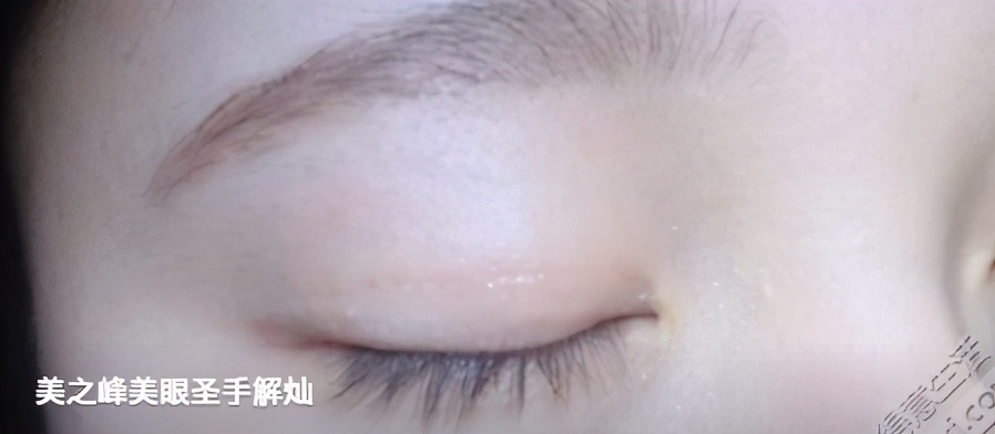 长沙美之峰解灿院长,长沙市美之峰医院美容整形怎么样