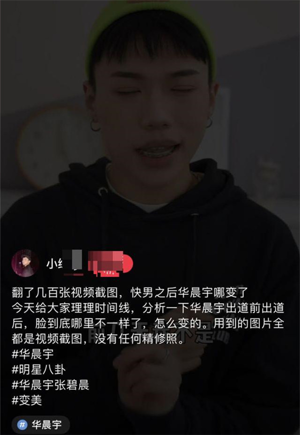 华晨宇陷入整容争议，素颜旧照被曝光，与如今的形象相差甚远