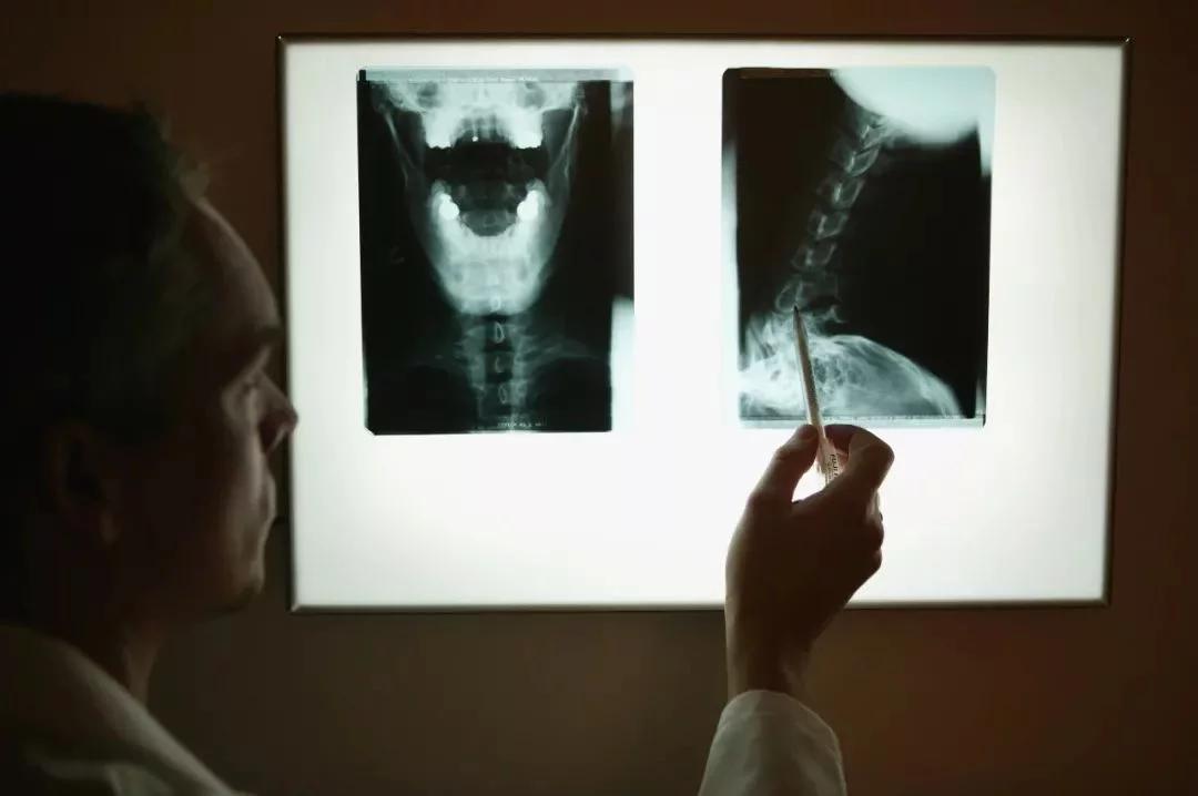 人体危险的三角区在哪里,人面部危险三角区