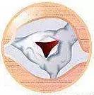 心脏使用说明及保养,心脏用药记忆口诀