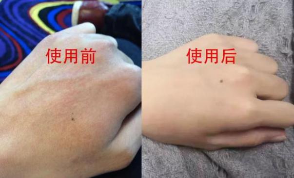 林志玲黄金,林志玲的价值