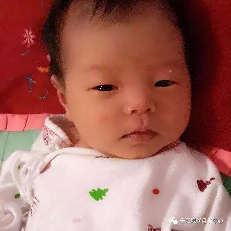 新生儿为什么会有马牙和螳螂嘴,新生儿长的马牙螳螂嘴要不要治