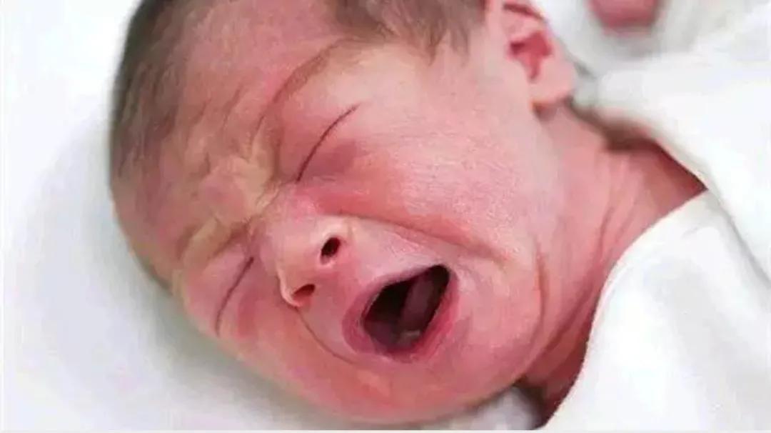 新生儿常见的皮肤问题,新生儿心脏血管常见问题