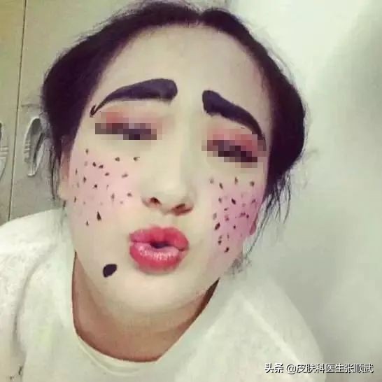 生下来特别小的痣长大变得很大,生下来就有的痣越长越大