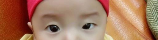 一单一双眼皮就不对称,左右眼皮不对称一单一双叫什么