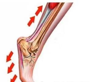 掌痛的最快解决办法,掌腕疼痛的治疗方法