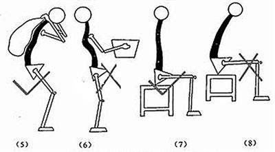 腰肌劳损艾灸治疗，干重体力活的人重灸肾俞别忘记环跳穴效果加倍