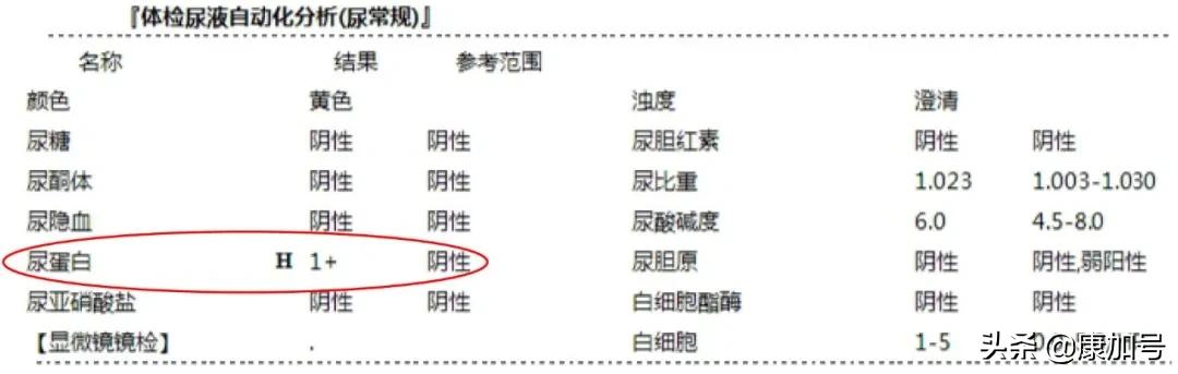 读懂体检单丨尿常规检查，能看出来肾好不好？一文教你看懂