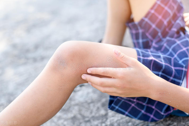 疤痕疙瘩发痒怎么治疗,疤痕疙瘩发痒涂什么药