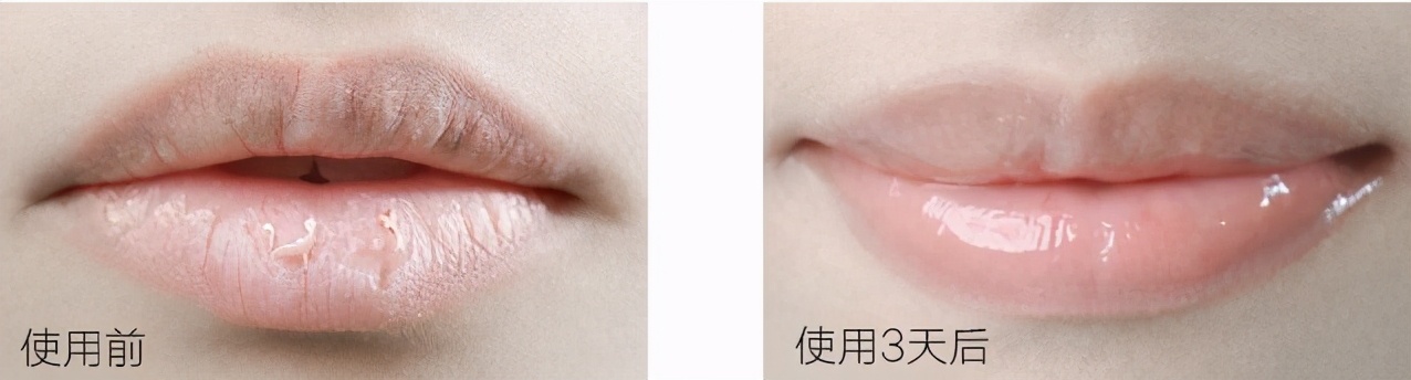 迪丽热巴嘴唇厚,正确脸部护肤步骤迪丽热巴