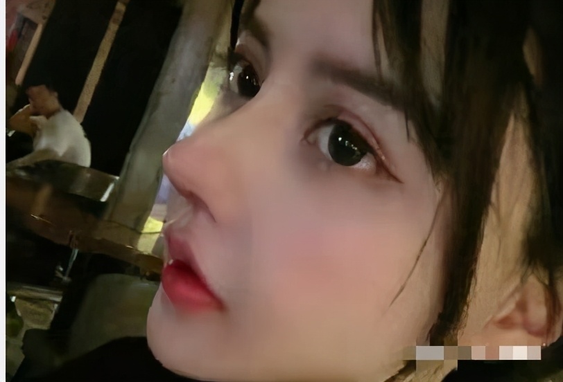 男生隆鼻很假,软骨隆鼻假吗