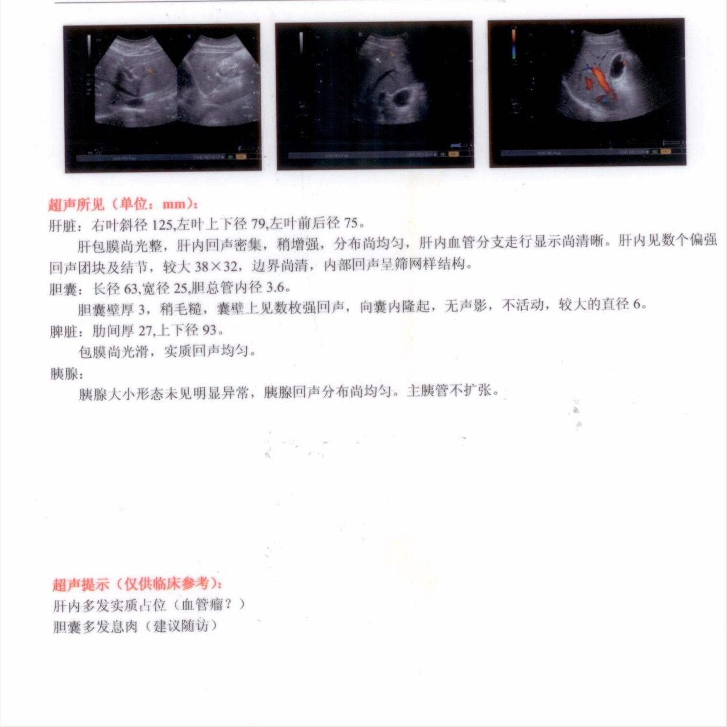 结节息肉囊肿增生哪个更容易癌变,结节囊肿增生息肉有什么区别