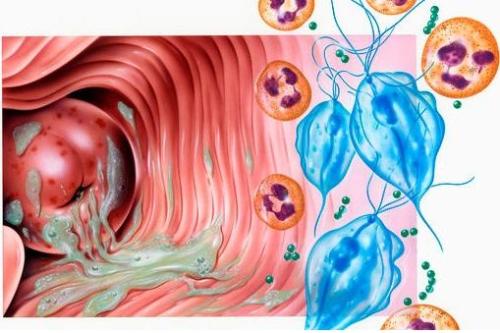 妇科炎症反复无常,究竟是什么原因造成的呢?