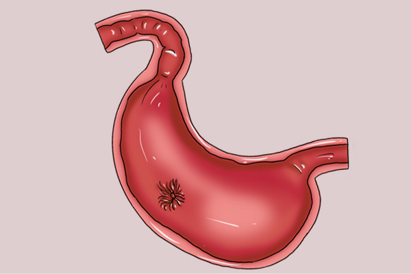 经常拉肚子肚子咕咕叫怎么回事,常拉肚子肚子咕咕的叫怎么回事