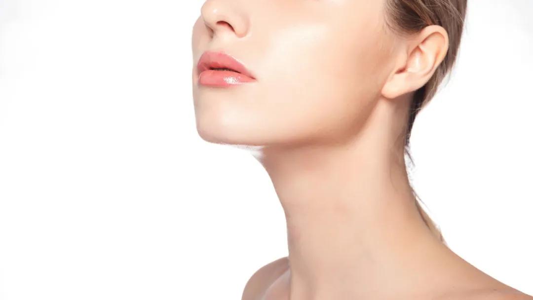 麦迪森身上长红痣,麦迪森身上长小红痣