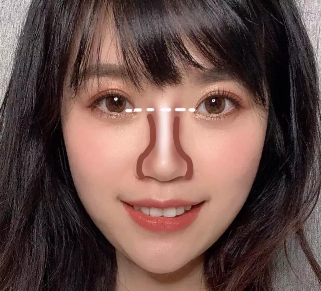 塌鼻子怎么办才显好看,塌鼻子如何让鼻根挺起来