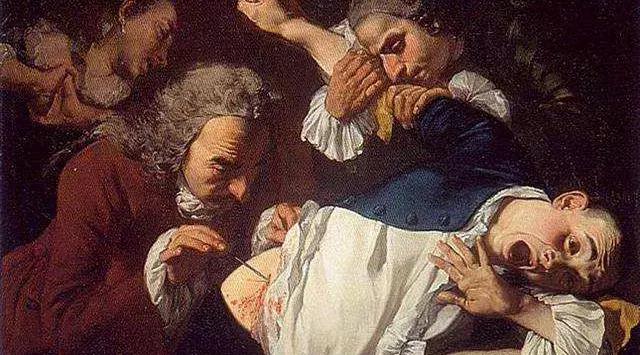 放血治梅毒穴位,水银治疗梅毒