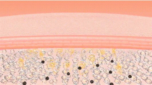 刘亦菲保养皮肤的方法,30岁皱纹多怎么修复