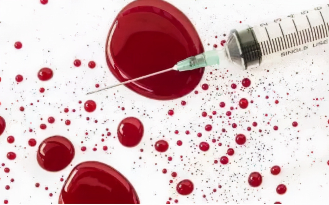 艾滋病窗口期会出现皮肤几种症状,艾滋病前期一定会出现皮肤问题吗